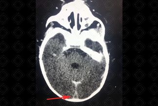 Texto alternativo para a imagem