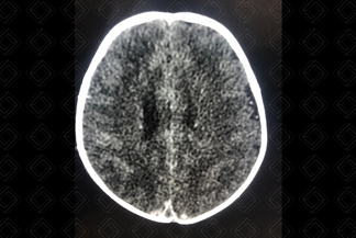 Texto alternativo para a imagem