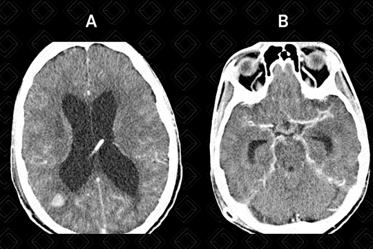 Texto alternativo para a imagem
