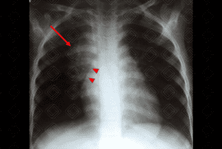 Texto alternativo para a imagem