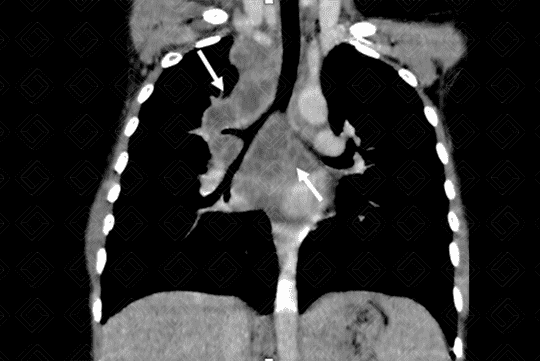 Texto alternativo para a imagem