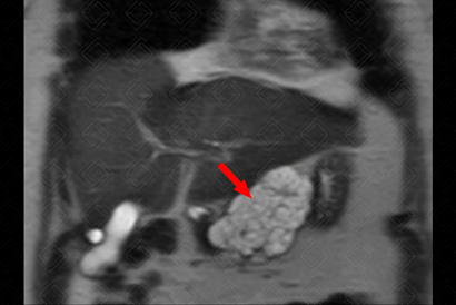 Texto alternativo para a imagem