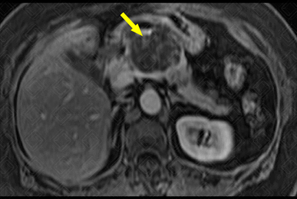 Texto alternativo para a imagem