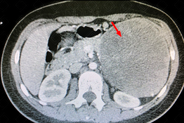 Texto alternativo para a imagem