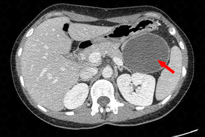 Texto alternativo para a imagem