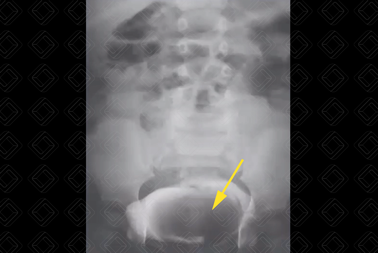 Texto alternativo para a imagem