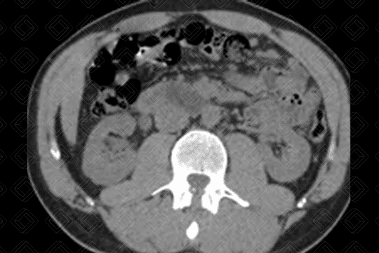 Texto alternativo para a imagem