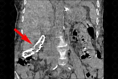 Texto alternativo para a imagem