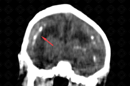 Texto alternativo para a imagem