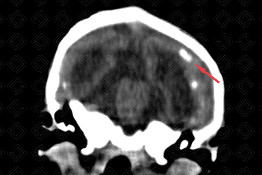 Texto alternativo para a imagem