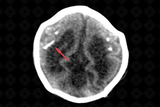 Texto alternativo para a imagem