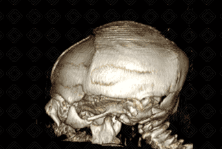 Texto alternativo para a imagem