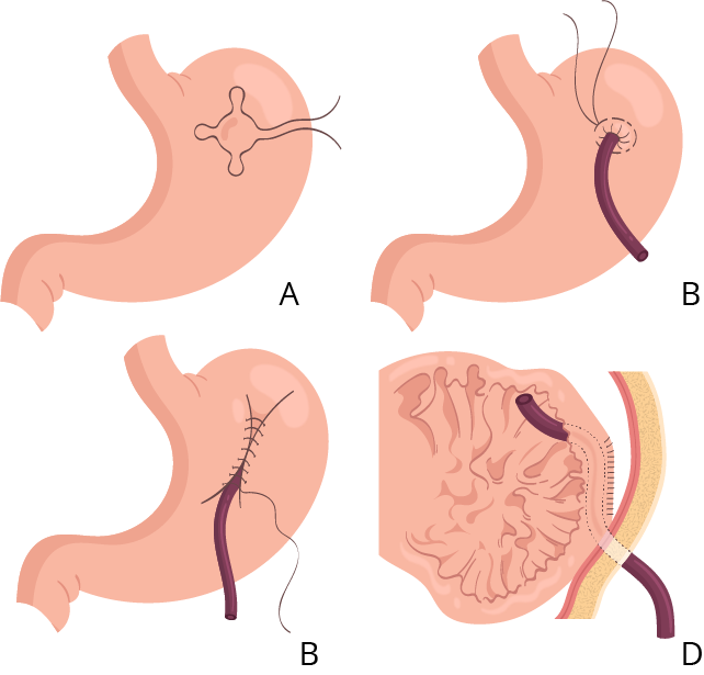 Texto alternativo para a imagem