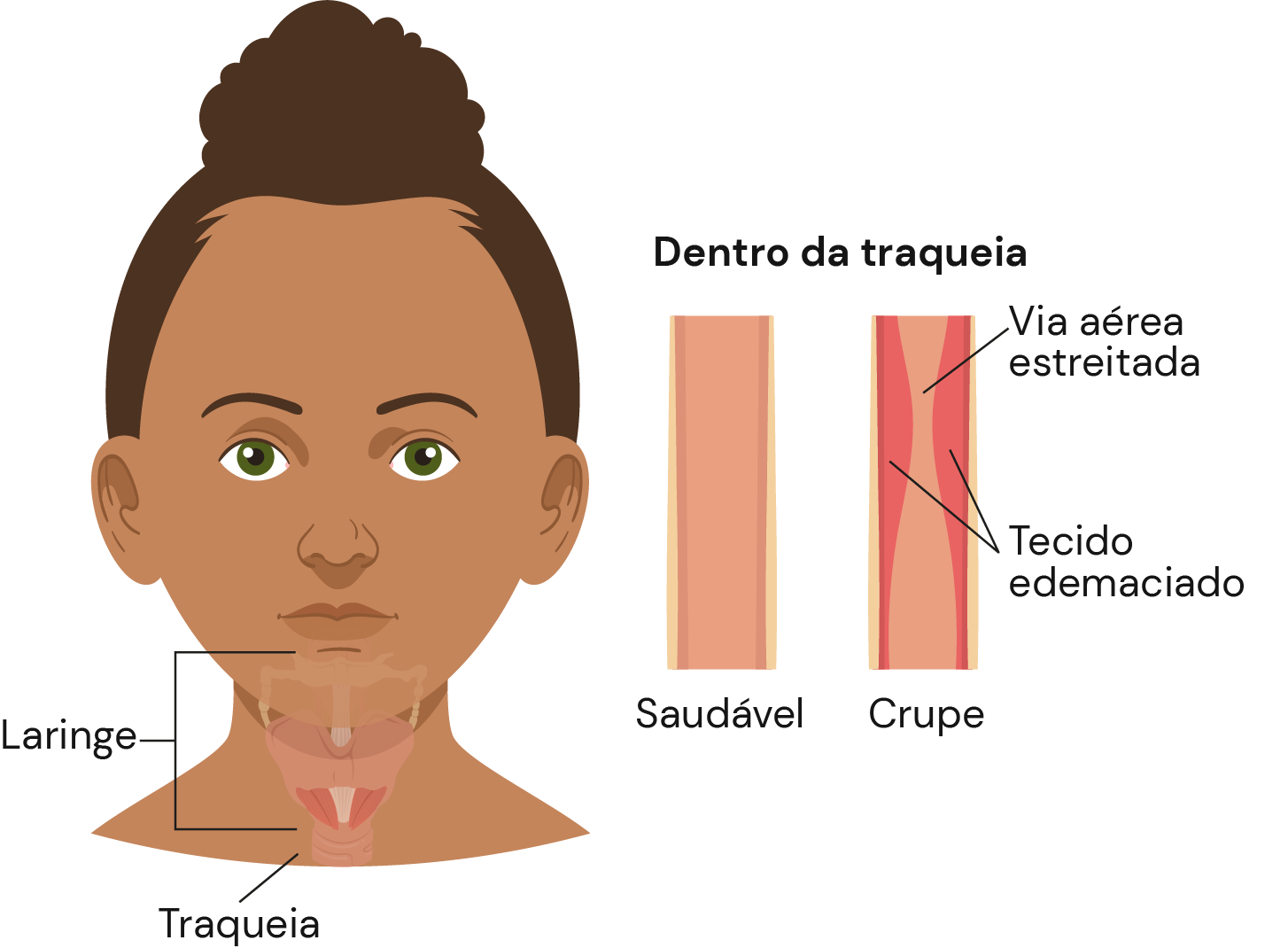 Texto alternativo para a imagem