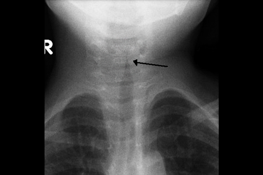 Texto alternativo para a imagem