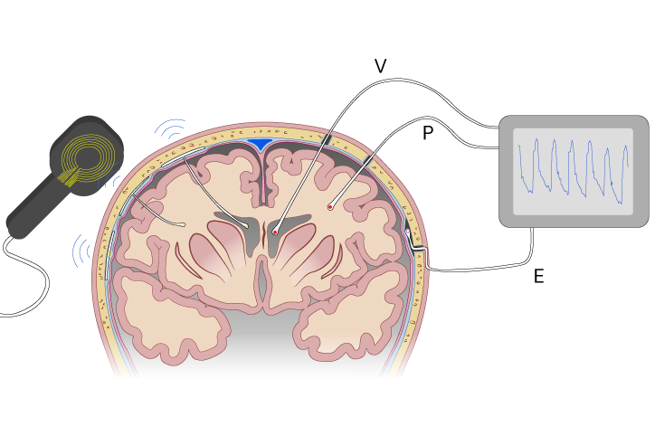 Texto alternativo para a imagem