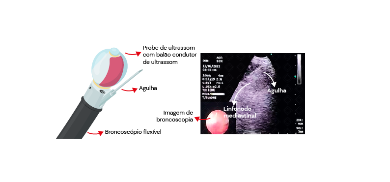 Texto alternativo para a imagem