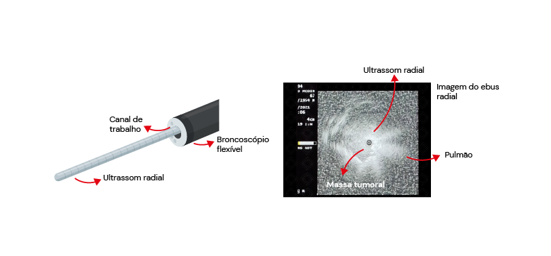 Texto alternativo para a imagem