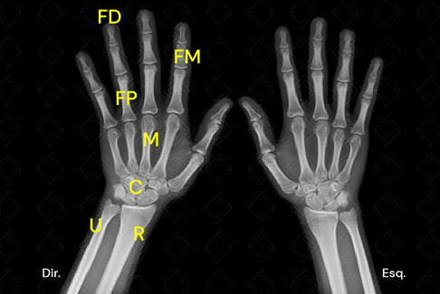 Texto alternativo para a imagem