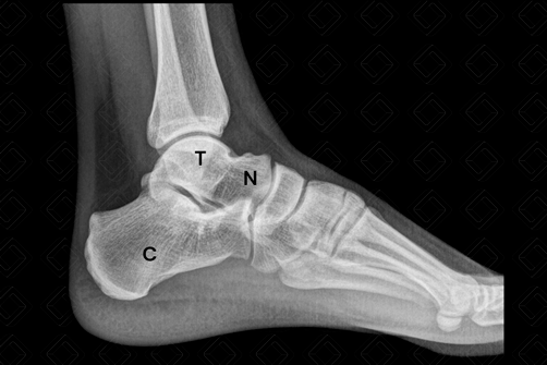 Texto alternativo para a imagem