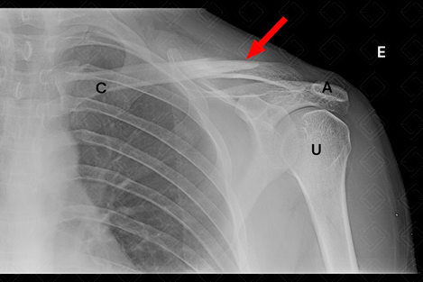 Texto alternativo para a imagem