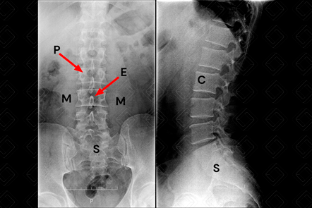 Texto alternativo para a imagem