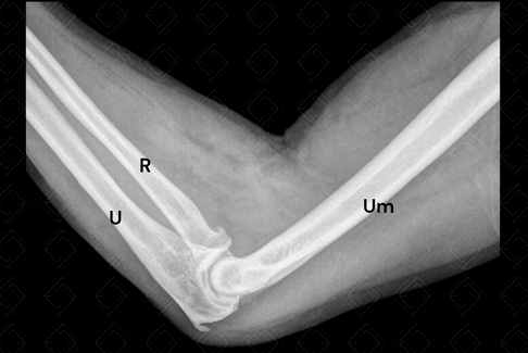 Texto alternativo para a imagem