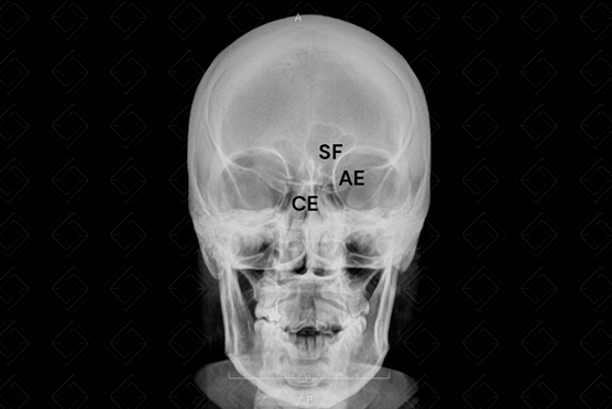 Texto alternativo para a imagem