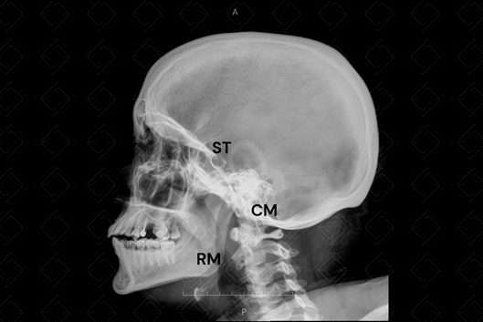 Texto alternativo para a imagem