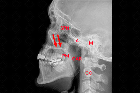 Texto alternativo para a imagem