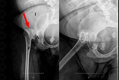 Texto alternativo para a imagem