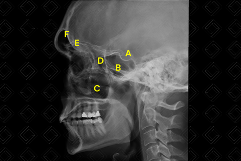 Texto alternativo para a imagem