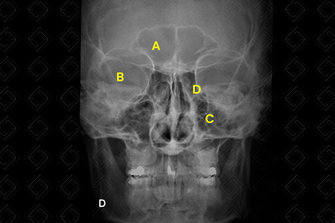 Texto alternativo para a imagem