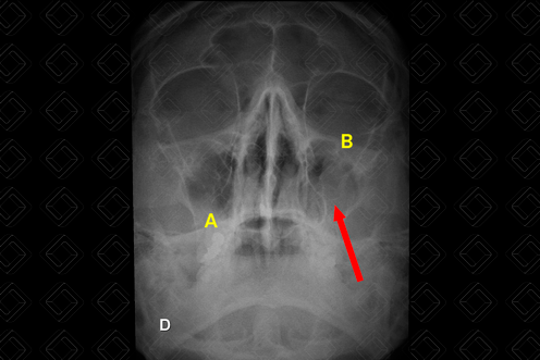 Texto alternativo para a imagem
