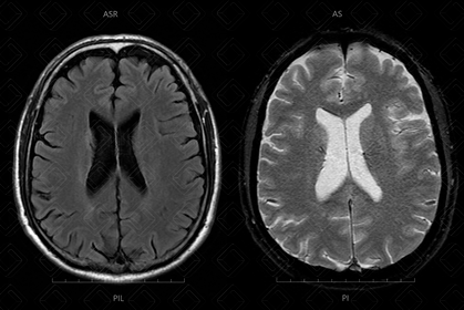 Texto alternativo para a imagem