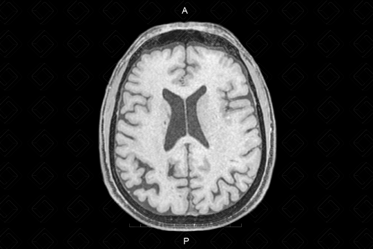 Texto alternativo para a imagem