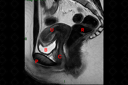 Texto alternativo para a imagem