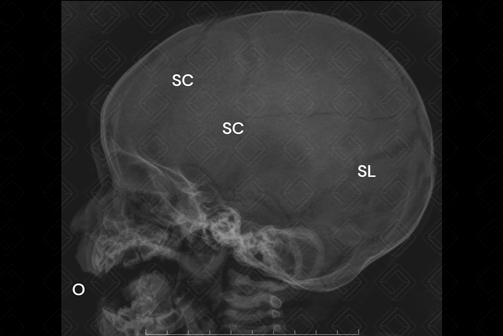 Texto alternativo para a imagem