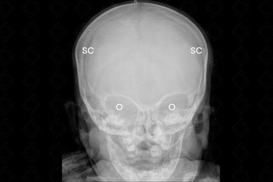 Texto alternativo para a imagem