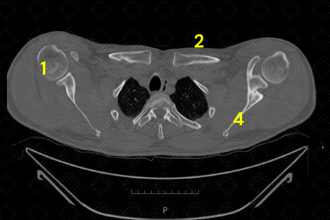 Texto alternativo para a imagem