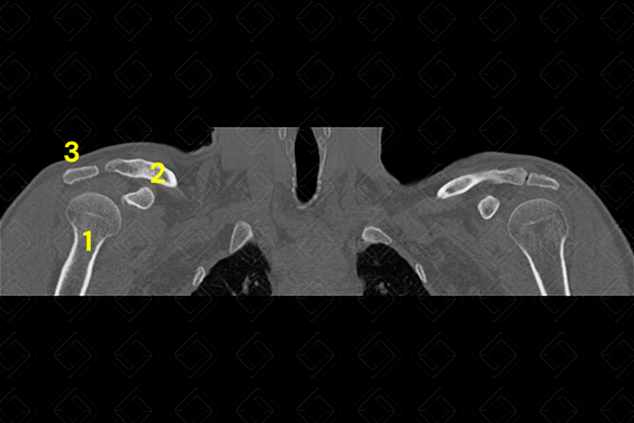 Texto alternativo para a imagem