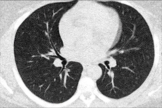 Texto alternativo para a imagem