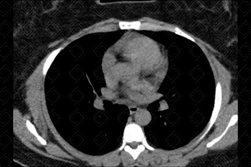 Texto alternativo para a imagem