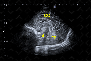 Texto alternativo para a imagem