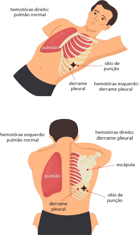 Texto alternativo para a imagem