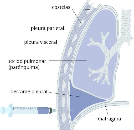 Texto alternativo para a imagem