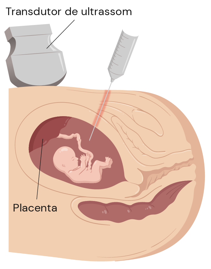 Texto alternativo para a imagem