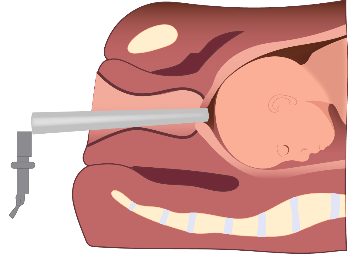 Texto alternativo para a imagem