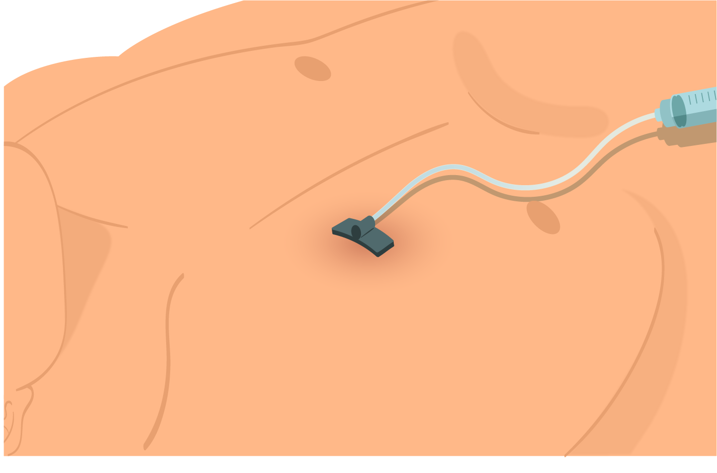 Texto alternativo para a imagem