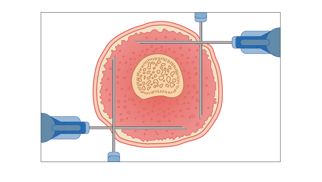 Texto alternativo para a imagem